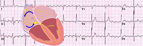 Flutter Auricular