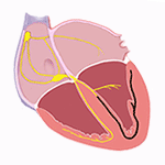 Left Fascicular Blocks (Left Hemiblocks)