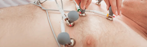 Electrodes de l'É́lectrocardiogramme