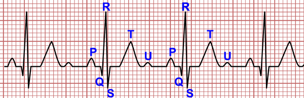 Ondas del EKG